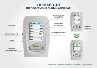 СКЭНАР-1-НТ (исполнение 01)  в Кузнецке купить Медицинская техника - denasosteo.ru 
